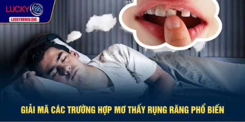 Giải mã các trường hợp mơ bị rụng răng